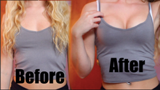 Upbra before and after